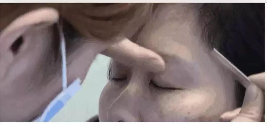 半永久纹眉多久补色 北京伊美尔健翔医院