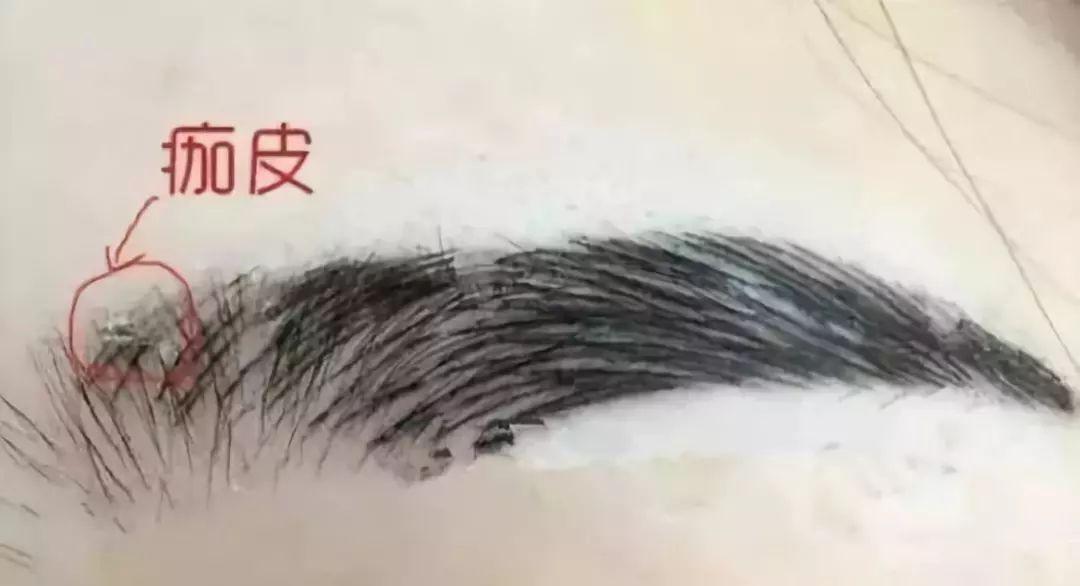 半永久纹眉多久补色 北京伊美尔健翔医院