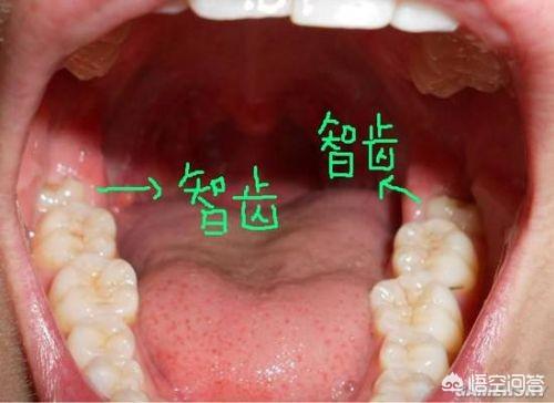 人类停止进化了吗?还是进化已缓慢到我们无法注意到的程度了?