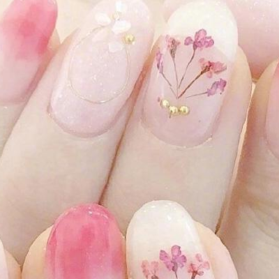 冻疮后手指变粗怎么办 如何消肿