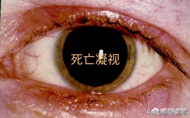 死人的眼睛里真的存留死之前的影像吗?法医尸检时候看死者双眼目的是什么?