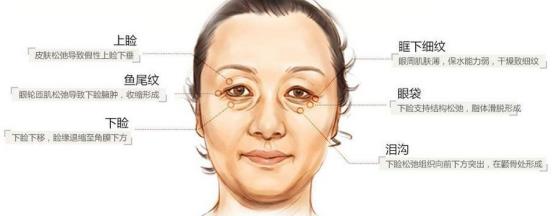 北京伊美尔健翔医院:肉毒素可以去皱吗