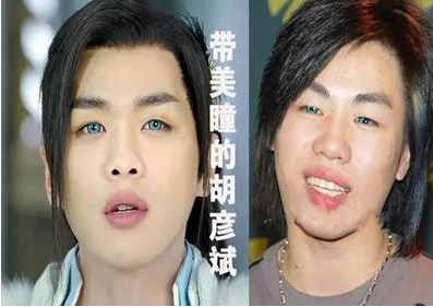 美瞳隐形眼镜的危害有哪些 蓝色美瞳电视剧
