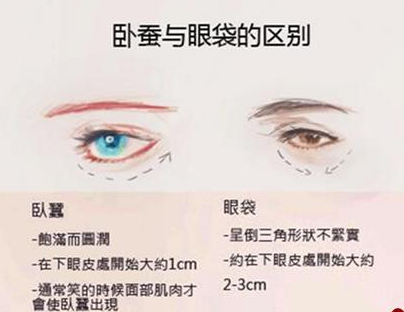 卧蚕和眼袋的区别 卧蚕画法步骤
