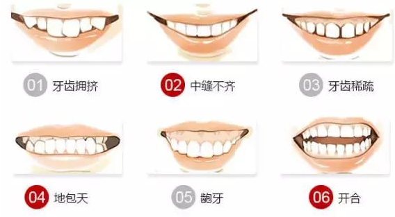 矫正牙齿的最佳年龄 成人适合吗