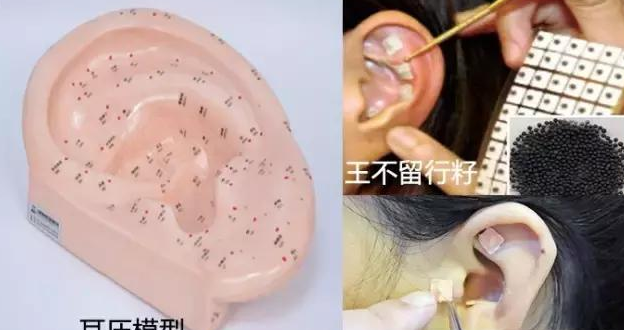 痔疮手术后疼痛怎么办 耳压中药熏洗能缓解