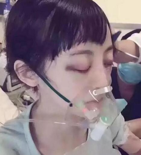淋巴癌的症状有哪些 能活多久
