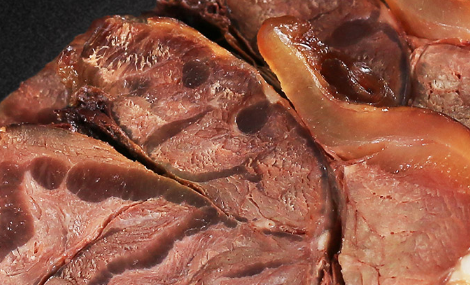 吃熟食的注意事項 室溫20度熟肉能放多久