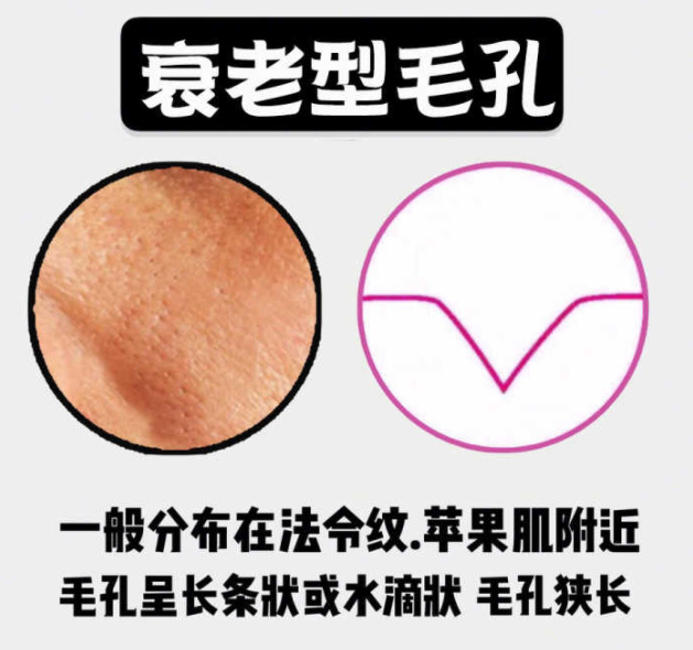 教你2个收缩毛孔的方法 有效收缩毛孔