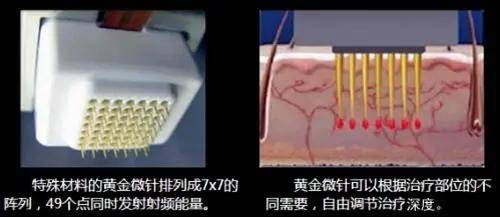 毛孔粗大几年了还能恢复吗 毛孔粗大怎么办