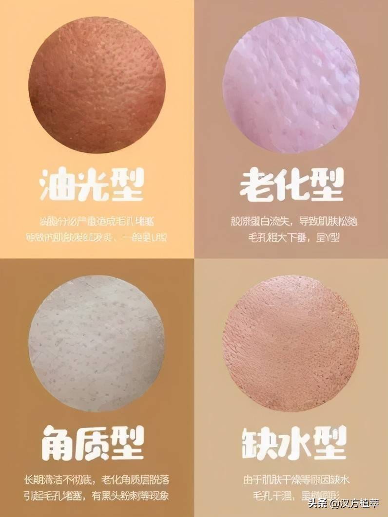 脸上都是毛孔用什么药能抹好 脸上毛孔大怎么办