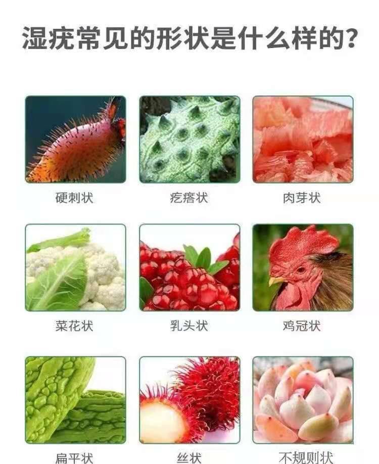 男性初期疣体是什么样子 尖锐湿疣怎么治
