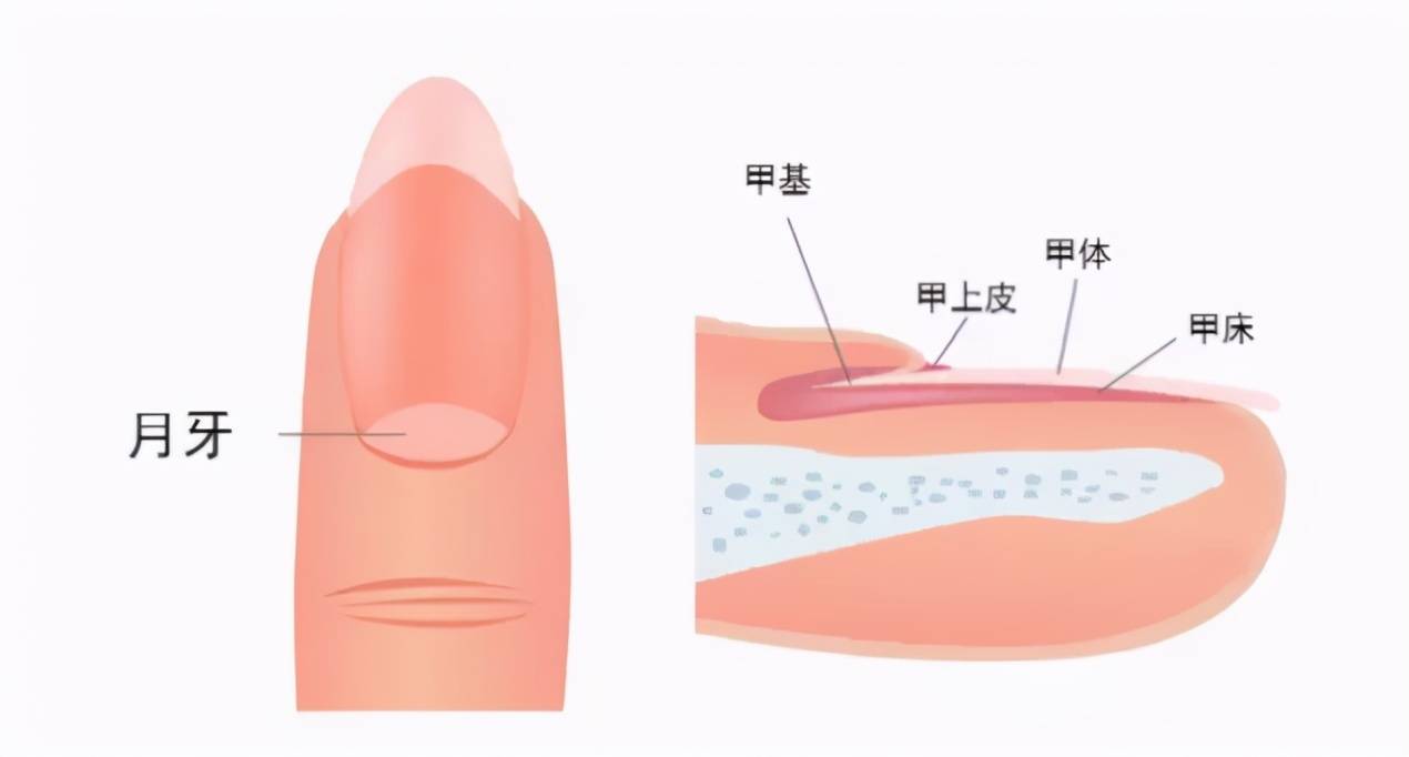 指甲上有白点是什么原因造成的 指甲上有白点是怎么回事
