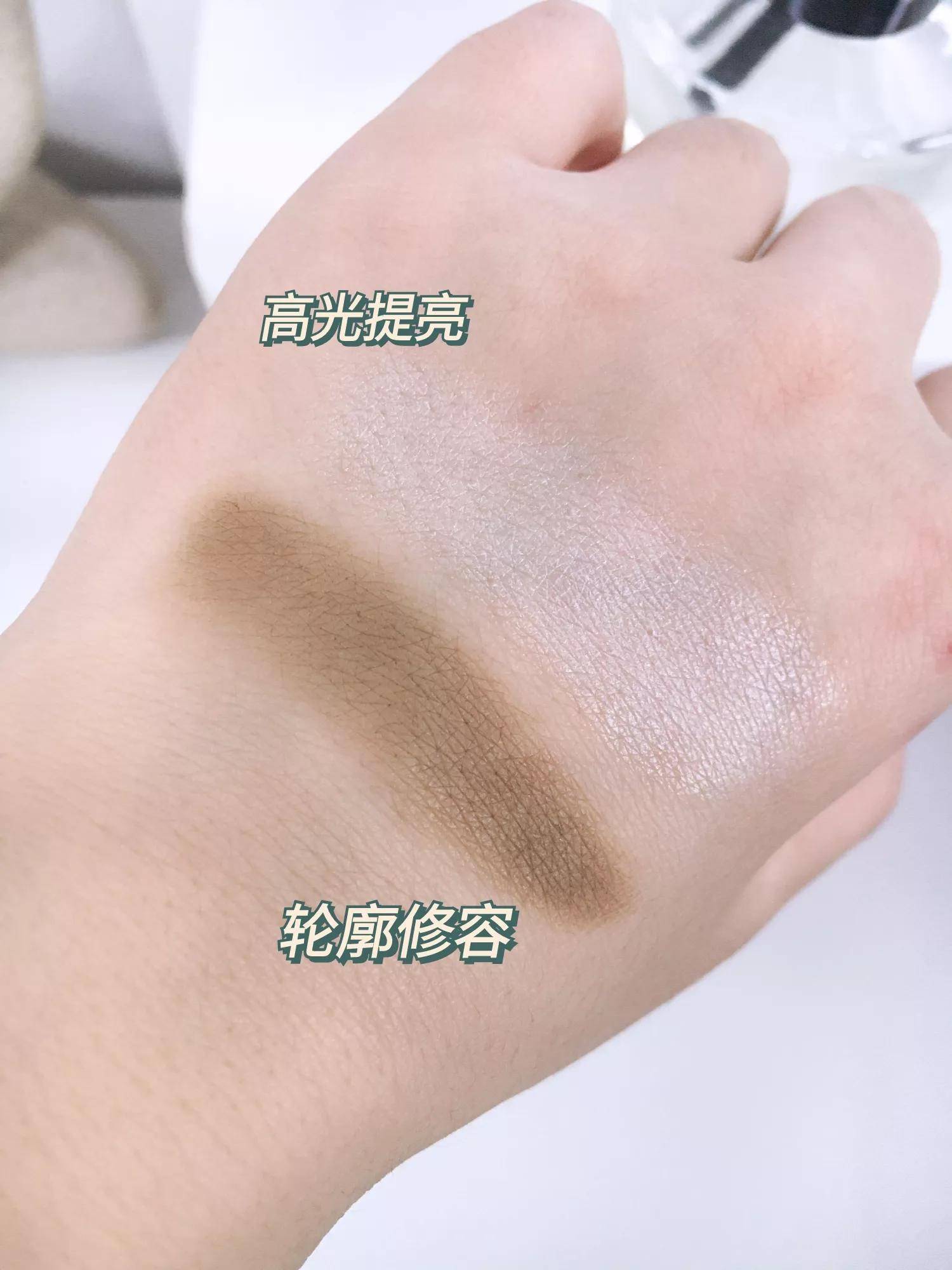 14岁蒜头鼻怎么改善 鼻翼大怎么办