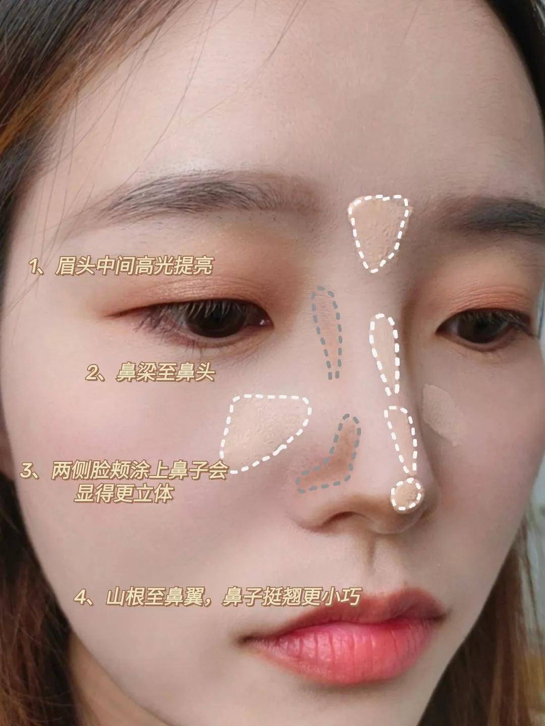 14岁蒜头鼻怎么改善 鼻翼大怎么办