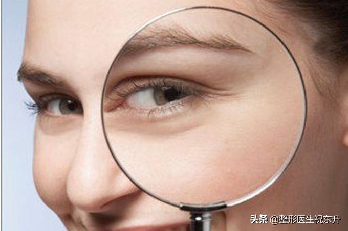 去眼袋最有效的小窍门 怎么治疗眼袋
