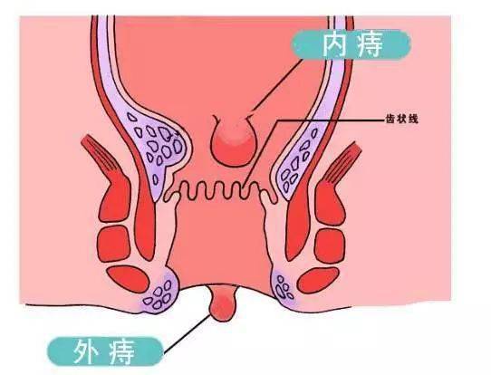 奥黛丽赫本和中国老公 奥黛丽赫本怎么死的