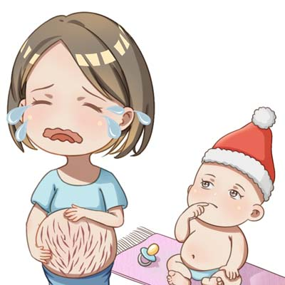 怎样去妊娠纹最有效的方法 妊辰纹怎么去除