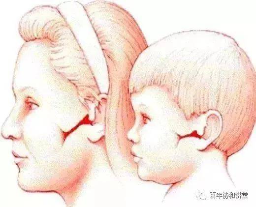 晚上侧身睡觉压得耳朵疼得要死 耳朵里面疼怎么回事