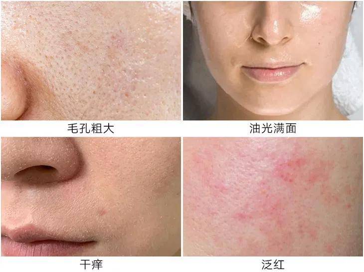 男士精华液图片 精华液怎么用