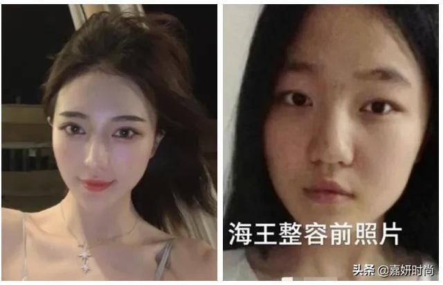 女海王项思醒整容前算美女么?
