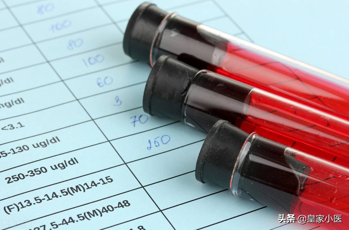 一招判断艾滋病 检测艾滋病多久出结果