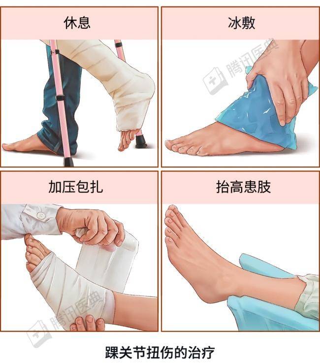 扭伤冷敷需要多长时间 扭伤多久冰敷