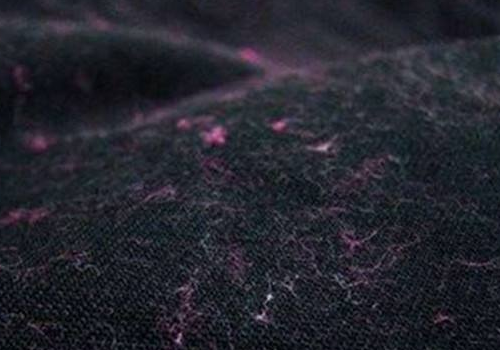 洗衣机洗衣服都是毛是怎么回事,怎么办