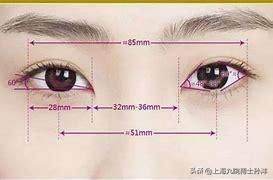 做双眼皮开内眼角恢复 开双眼皮多久恢复
