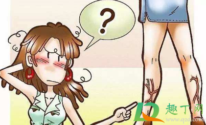 静脉曲张需不需要做手术