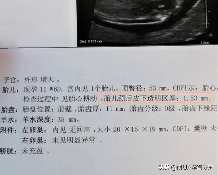 nt检查的一般几分钟 nt检查多久