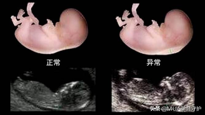 nt检查的一般几分钟 nt检查多久