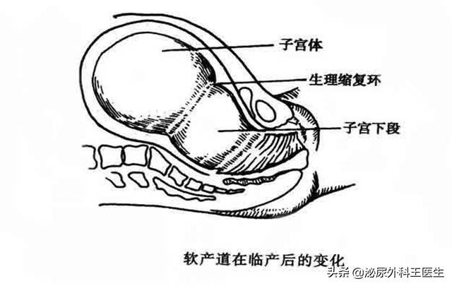 子宫全切手术时间多长 子宫全切多久