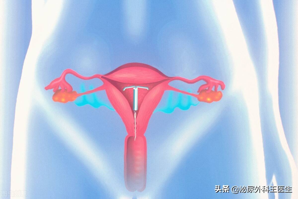 子宫全切手术时间多长 子宫全切多久