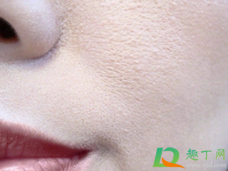 嘴角卡粉起皮怎么办