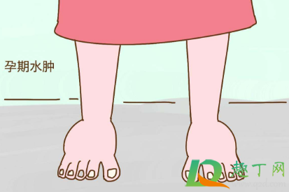 怀孕脚脖子肿了应该冷敷还是热敷