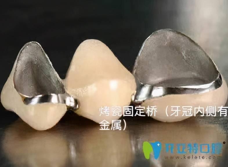 抽牙神经要抽多少次 抽牙神经多久