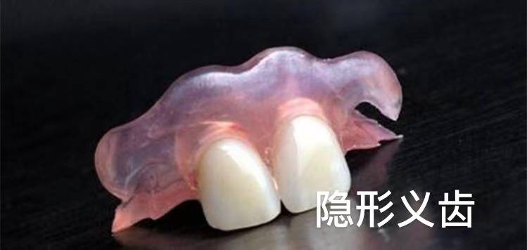 抽牙神经要抽多少次 抽牙神经多久