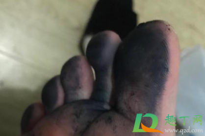 鞋子褪色到丝袜上怎么办