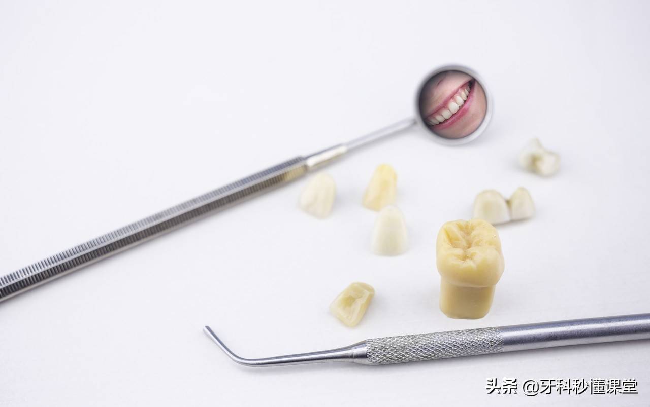 做三颗烤瓷牙需要多长时间 做烤瓷牙多久