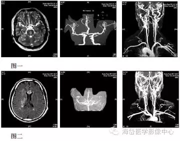 腿上血管炎的症状图片 血管炎能活多久