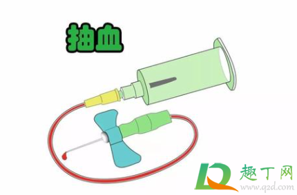 查过敏原抽哪的血