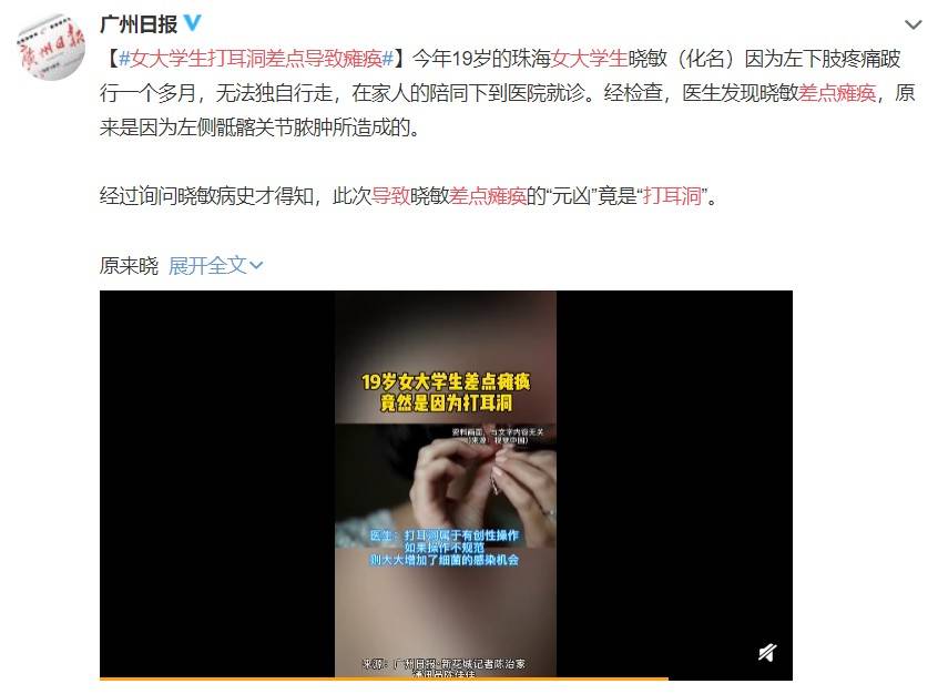 打了耳洞多久才能彻底好 耳洞多久能长好