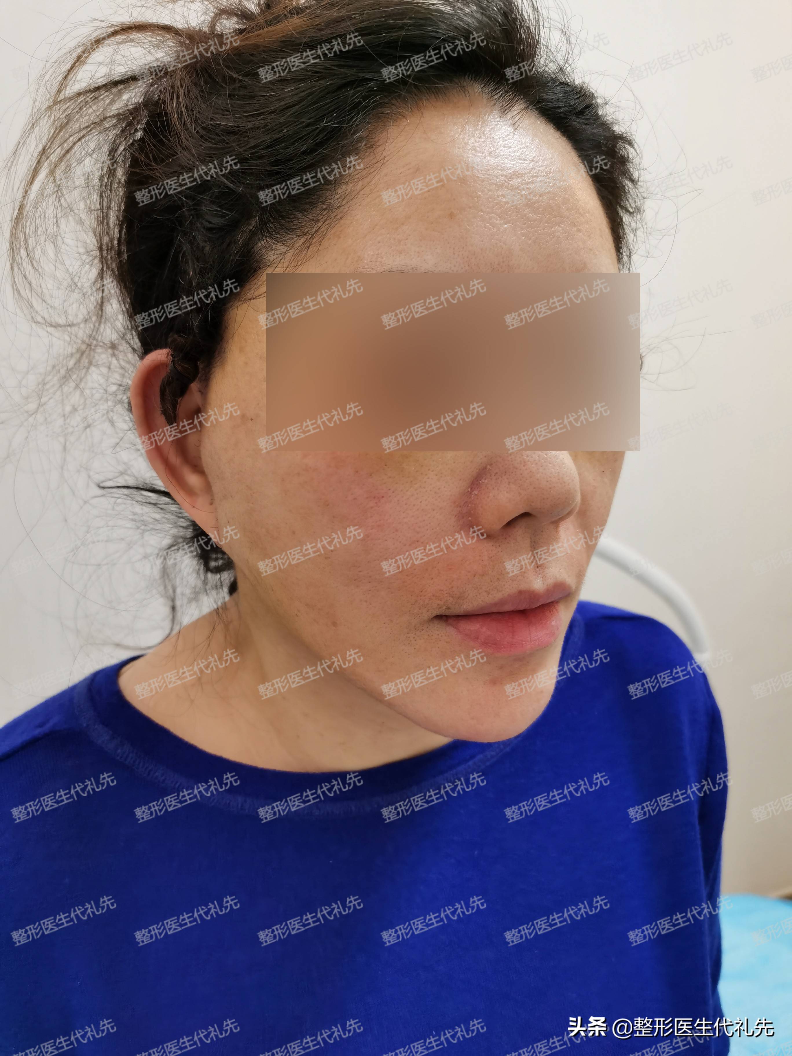 大型手术后身体恢复期 手术后多久才能恢复
