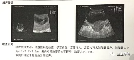 验孕棒分早晚吗 正常多久怀孕