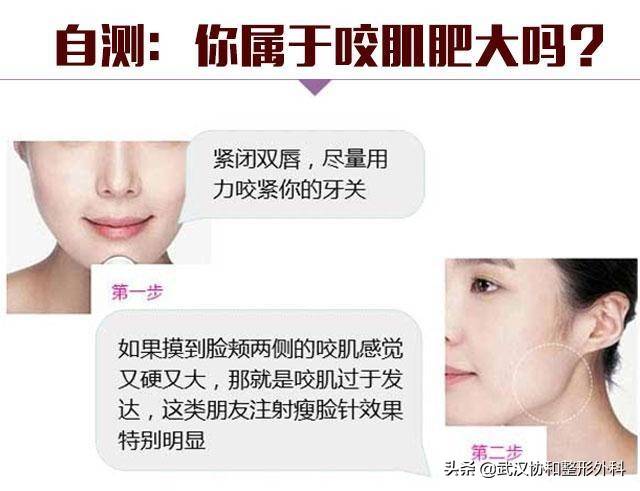 瘦脸针最多能维持多久 瘦脸针能坚持多久