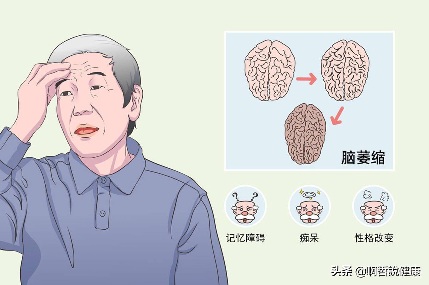 小脑萎缩最怕什么刺激 小脑萎缩能活多久