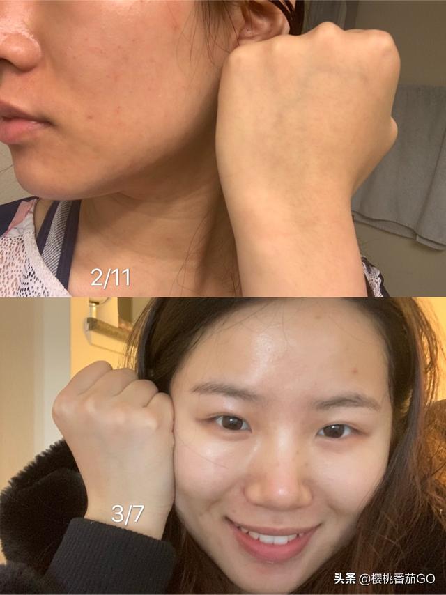 肤色暗黄,有什么护肤品可以提亮肤色?