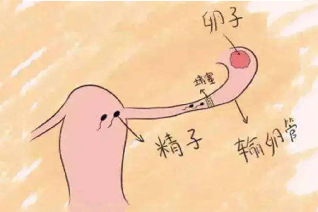 宫外孕保守治疗多久可以做造影 做造影多久可以怀孕