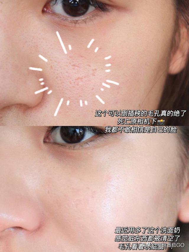 大佬们,哪个洗面奶可以有效的去除毛孔,其他app怕被自媒体骗?